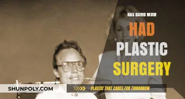 David Muir Plastic Surgery: Fact-Checking the Rumors and Speculations