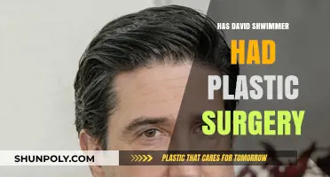 David Schwimmer's Transformation: Plastic Surgery Rumors Explored