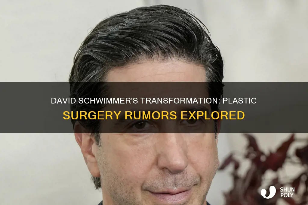 has david shwimmer had plastic surgery