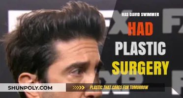 Has David Schwimmer Had Plastic Surgery? Unveiling the Truth