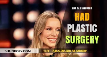 Dax Shepard Plastic Surgery: Fact-Checking the Rumors and Speculations