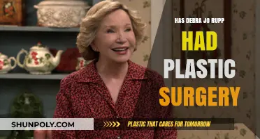 Debra Jo Rupp Plastic Surgery: Fact-Checking the Rumors and Speculations