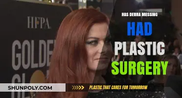 Debra Messing Plastic Surgery: Fact-Checking the Rumors and Speculations
