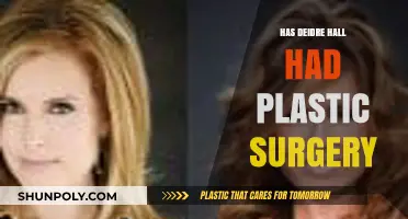 Deidre Hall Plastic Surgery: Fact-Checking the Rumors and Speculations