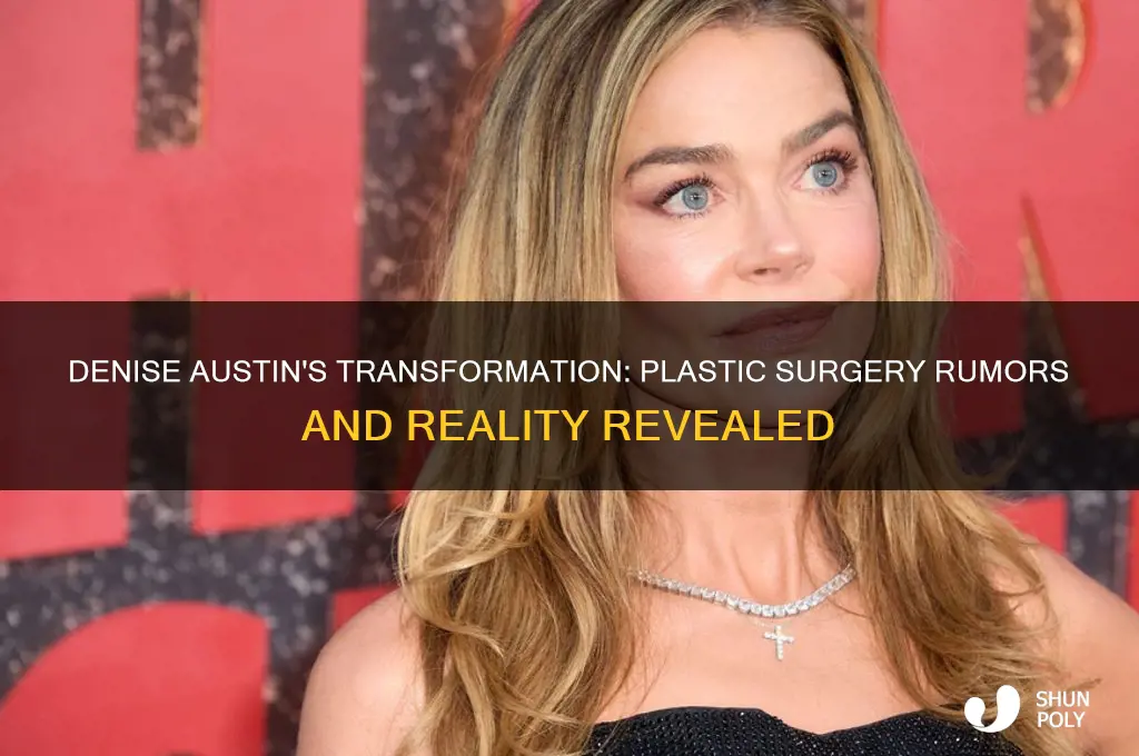 has denise austin had plastic surgery