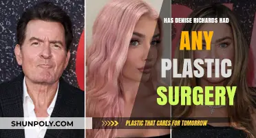 Denise Richards Plastic Surgery: Fact-Checking Rumors and Speculations