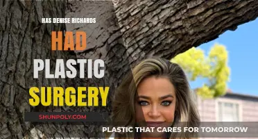 Denise Richards Plastic Surgery: Fact-Checking Rumors and Speculations