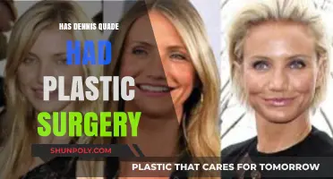 Has Dennis Quaid Undergone Plastic Surgery? Examining the Rumors