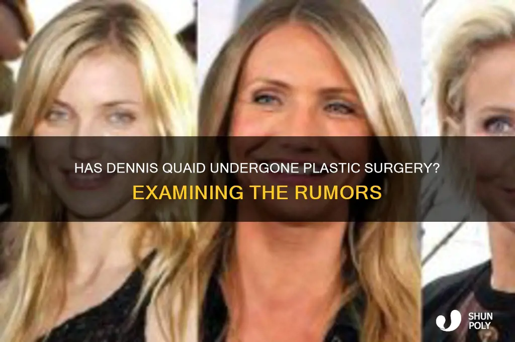 has dennis quade had plastic surgery