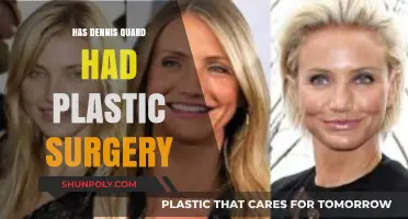 Dennis Quaid's Transformation: Plastic Surgery Rumors Explored and Analyzed
