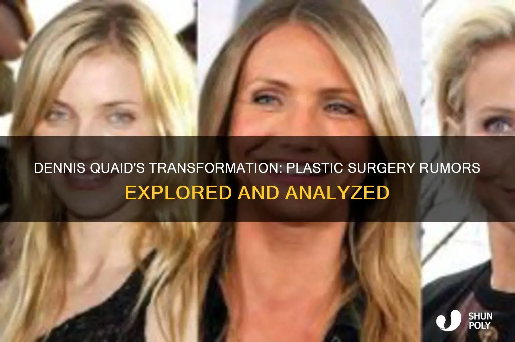 has dennis quard had plastic surgery
