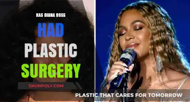 Diana Ross Plastic Surgery: Fact-Checking the Rumors and Speculations