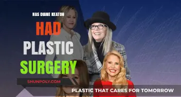 Diane Keaton's Ageless Look: Plastic Surgery Speculations Explored