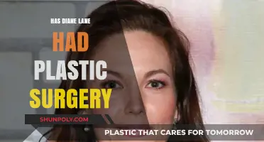 Diane Lane's Ageless Beauty: Plastic Surgery Speculations Explored