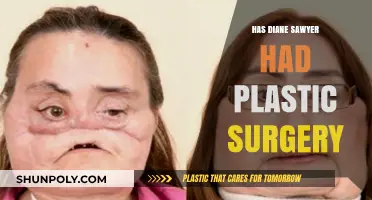 Diane Sawyer's Appearance: Plastic Surgery Rumors and Speculations Explored