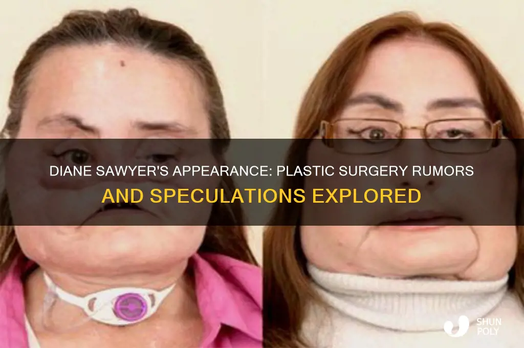 has diane sawyer had plastic surgery