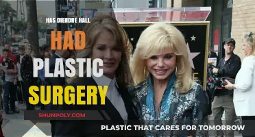 Deirdre Hall's Transformation: Plastic Surgery Rumors and Speculations Explored