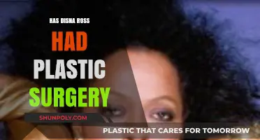 Has Dina Ross Undergone Plastic Surgery? Unveiling the Truth