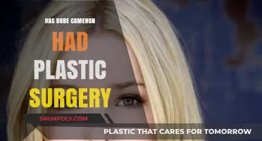 Has Dove Cameron Undergone Plastic Surgery? Exploring the Rumors and Facts