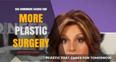 Dominique Sachse's Plastic Surgery: Unveiling the Truth Behind Her Transformation