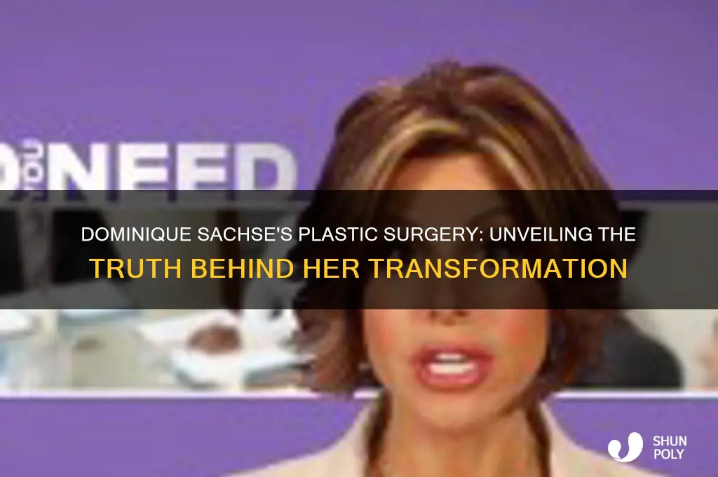 has dominique sachse had more plastic surgery