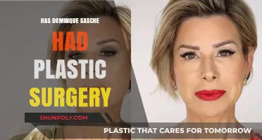 Dominique Sachse's Transformation: Plastic Surgery Rumors and Reality