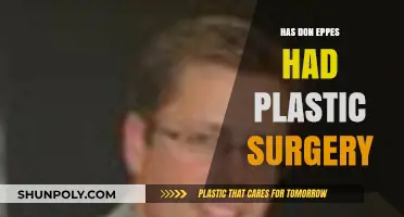 Has Don Eppes Had Plastic Surgery? Uncovering the Truth