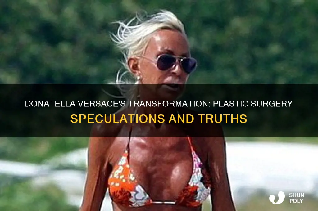 has donatella had plastic surgery