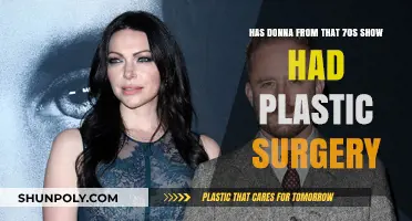 Donna from That '70s Show: Plastic Surgery Speculations Explored