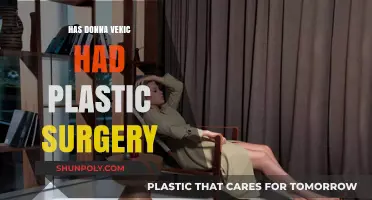 Donna Vekic Plastic Surgery Speculations: Fact or Fiction?