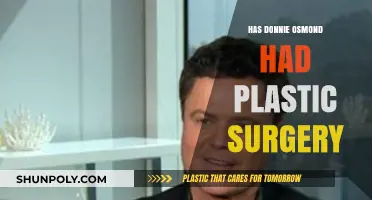 Donnie Osmond's Transformation: Plastic Surgery Rumors Explored
