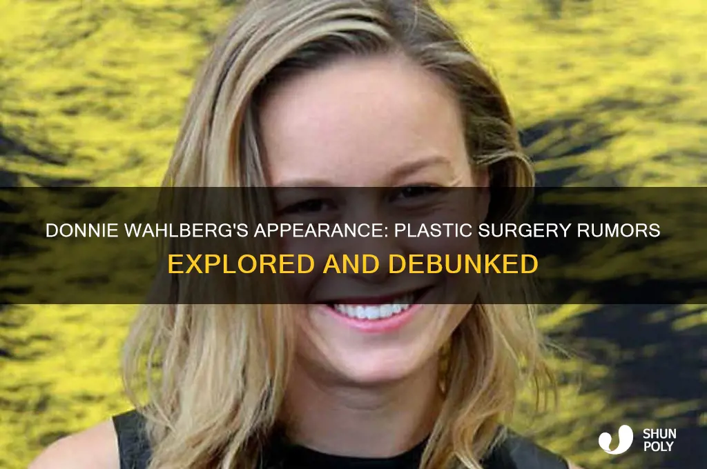 has donnie wahlberg had plastic surgery