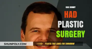 Donny's Transformation: Unveiling the Truth About Plastic Surgery Rumors