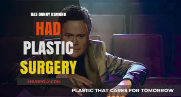 Donny Osmond's Youthful Look: Plastic Surgery or Natural Glow?