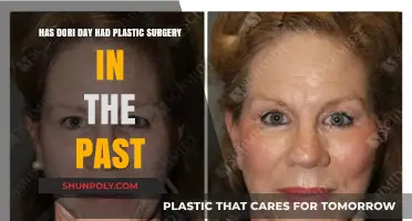 Dori Day's Transformation: Unveiling the Truth About Plastic Surgery