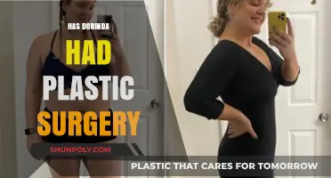 Dorinda's Transformation: Plastic Surgery Rumors and Reality Revealed
