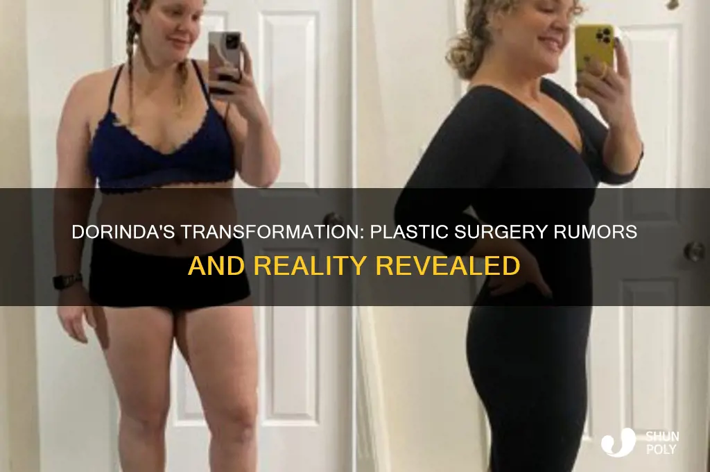 has dorinda had plastic surgery