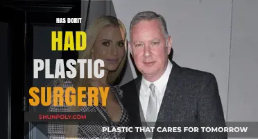 Has Dorit Had Plastic Surgery? Unveiling the Truth Behind Her Look