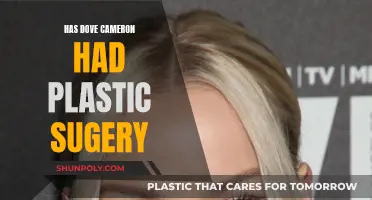 Dove Cameron's Plastic Surgery: What's the Truth?