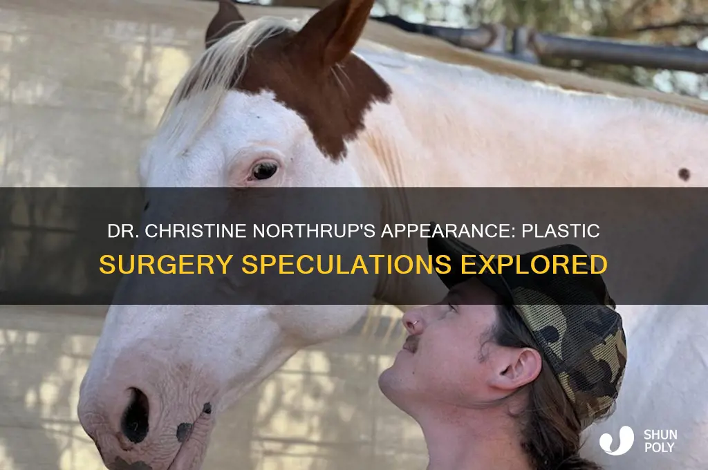 has dr christine northrup had plastic surgery