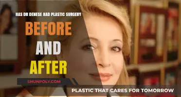 Dr. Denese's Transformation: Plastic Surgery Before and After Revealed