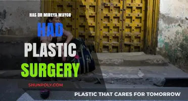 Dr. Mireya Mayor Plastic Surgery: Fact-Checking the Rumors and Speculations