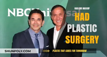 Dr. Nassif's Transformation: Unveiling the Truth About His Plastic Surgery