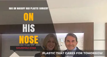 Dr. Nassif's Nose: Plastic Surgery Speculations and Truths