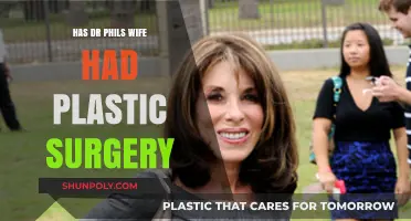 Has Dr. Phil's Wife Had Plastic Surgery? The Truth Revealed