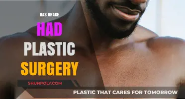 Drake's Transformation: Unveiling the Truth About His Plastic Surgery Rumors