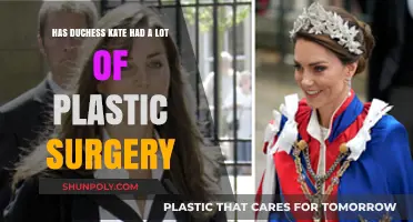 Duchess Kate's Transformation: Plastic Surgery Rumors and Reality