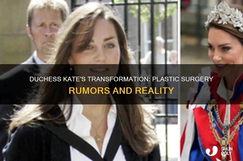 has duchess kate had a lot of plastic surgery