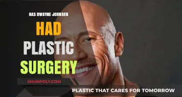 Dwayne Johnson's Transformation: Plastic Surgery Rumors Explored