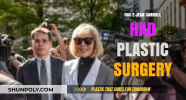 E. Jean Carroll Plastic Surgery: Fact-Checking the Rumors and Speculation
